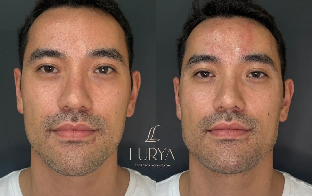 Harmonização Facial Lurya Clinic Praia Grande